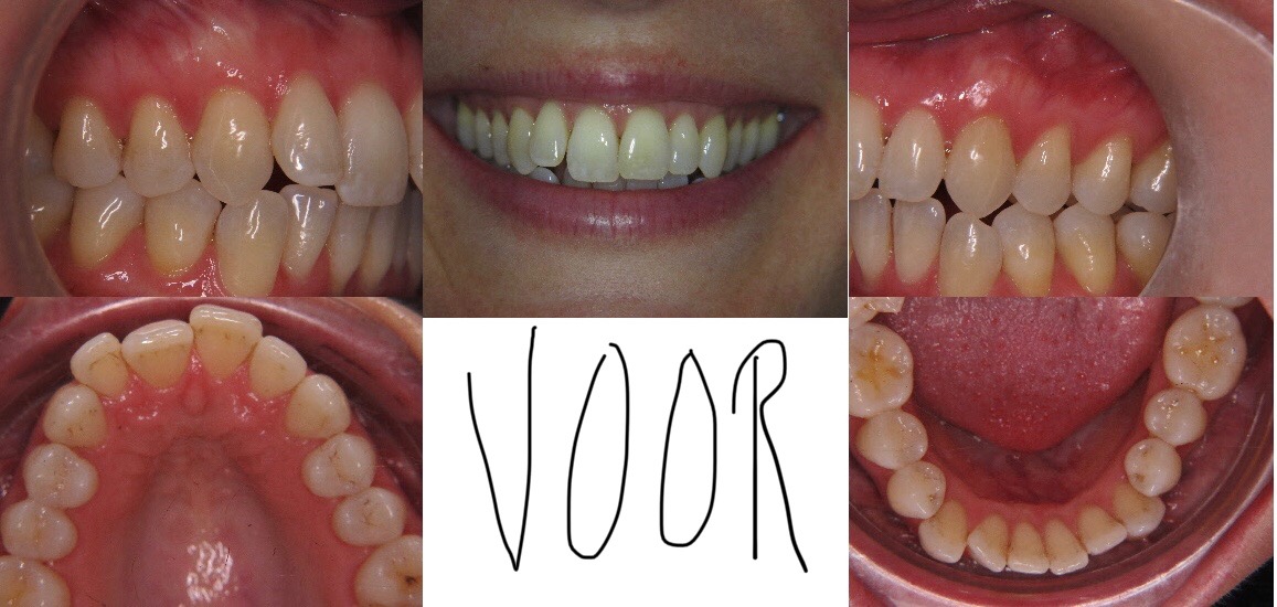 Resoneer referentie trainer Orthodontie - Onze behandelingen | De Drietand - Maastricht